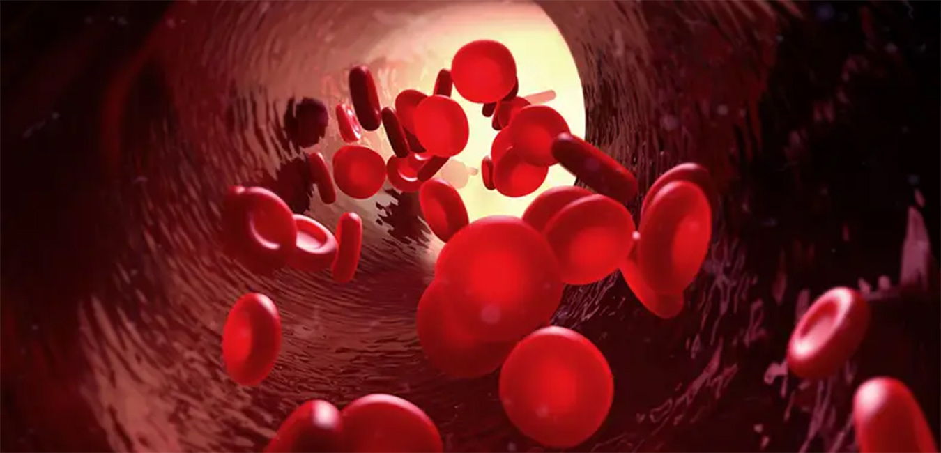 Leukapheresis